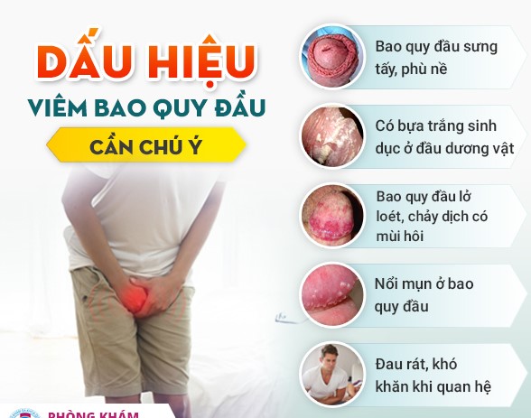 Bệnh viêm quy đầu biểu hiện và phương pháp điều trị