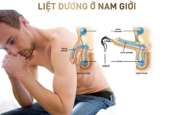 Liệt dương có ảnh hưởng nghiêm trong như thế nào?